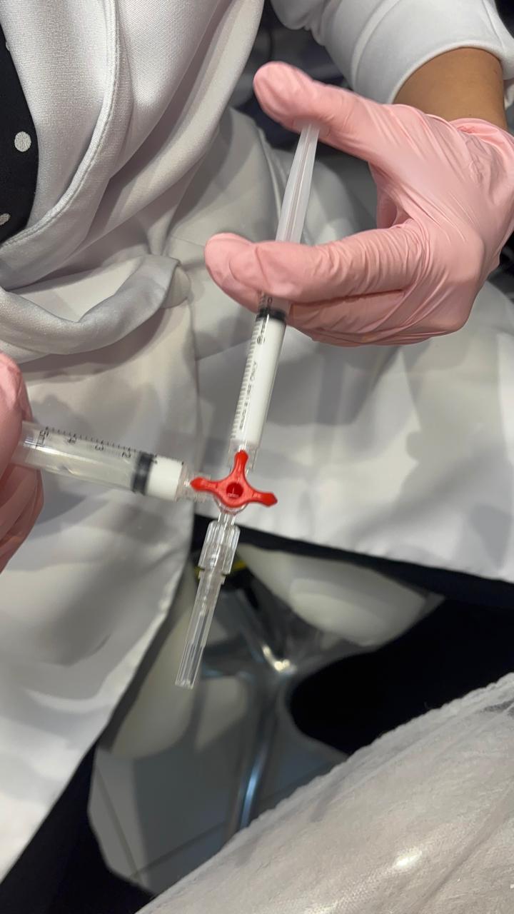 Preparo de escleroterapia com microespuma